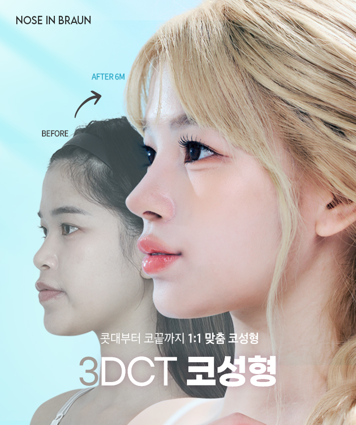 3DCT코성형