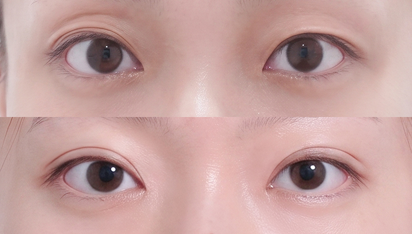 전후사진